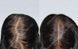 TRX2 Hair Growth Complex - Молекулярний комплекс проти випадіння волосся OXFORD BIOLABS, 1 банка * 90 капсул (1 місяць)