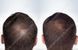 TRX2 Hair Growth Complex - Молекулярний комплекс проти випадіння волосся OXFORD BIOLABS, 1 банка * 90 капсул (1 місяць)